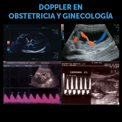 Imagen del curso de Doppler obstétrico y ginecológico de Ágora Médica