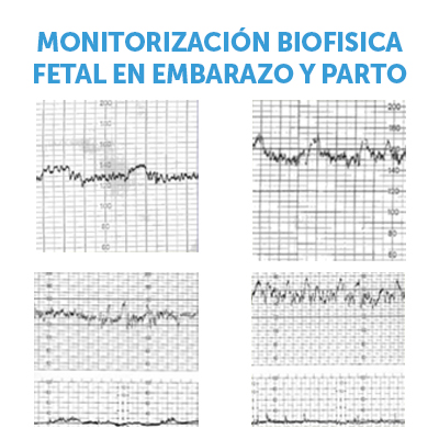 Curso de monitorización fetal en embarazo y parto de Ágora Médica