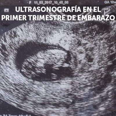 Imagen del curso de ultrasonografía obstétrica del primer trimestre de Ágora Médica