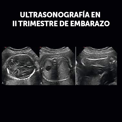 Imagen del curso de ultrasonografía obstétrica del segundo trimestre de Ágora Médica