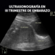 Ecografía obstétrica del tercer trimestre con referencias anatómicas a placenta, vejiga y cuello uterino.
