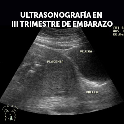 Ecografía obstétrica del tercer trimestre con referencias anatómicas a placenta, vejiga y cuello uterino.